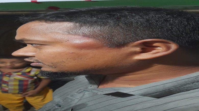 বোয়ালখালীতে সংবাদ প্রকাশের জেরে সাংবাদিকের উপর হামলা