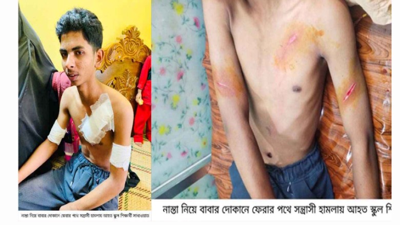 মিরসরাই হোটেল থেকে রুটি আনতে গিয়ে সন্ত্রাসীদের হামলার শিকার 