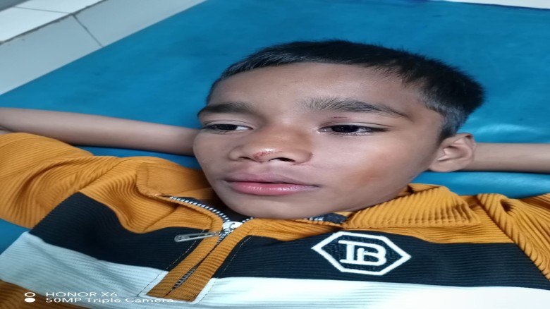 আনোয়ারায় তুচ্ছ ঘটনায় মাদ্রাসাছাত্রকে পিটিয়ে গুরুতর জখম