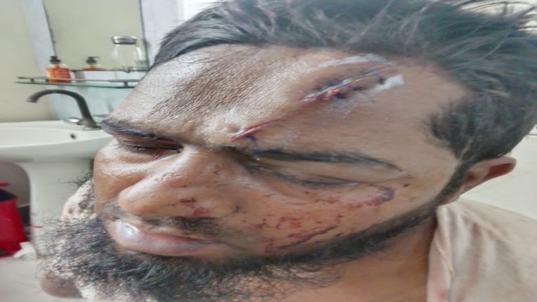 আনোয়ারায় প্রতিবেশীর হাতুড়ির আঘাতে  প্রতিবন্ধী যুবক আহত