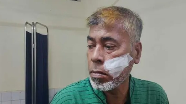 পটিয়ায় মসজিদের মোতোয়াল্লির ওপর হামলার অভিযোগ যুবদল নেতার বির
